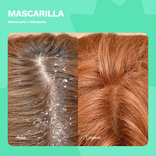 Mascarilla Refrescante Hidratante | Control Caspa | BE FREE | 8 OZ / 240 ML