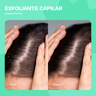 Exfoliante Capilar para una limpieza profunda | BE FREE | 8 OZ / 240 ML
