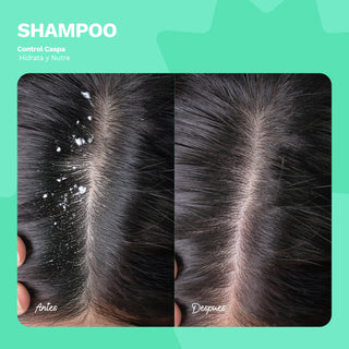 Shampoo Control Caspa - Hidrata y Nutre | BE FREE | 12 OZ / 355 ML